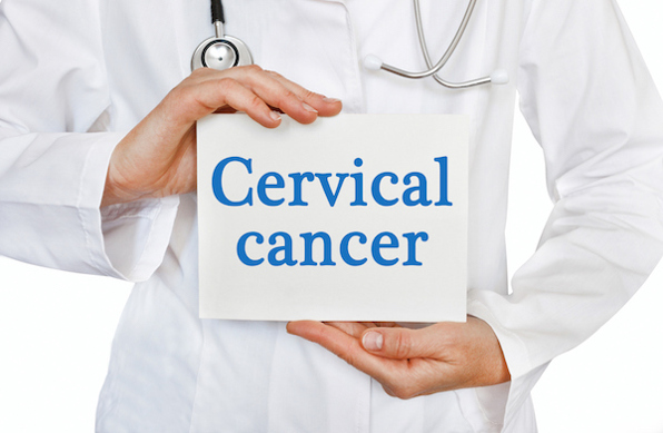 Cervical Cancer What You Need To Know 